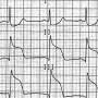 ekg-quiz6aa.jpg