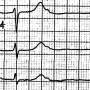 ekg-quiz9ad.jpg